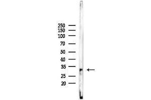 anti-Homeobox D10 (HOXD10) (Internal Region) antibody
