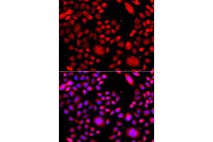 Immunofluorescence analysis of A549 cell using RAC3 antibody.