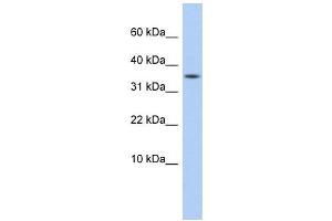 DYSFIP1 antibody used at 1 ug/ml to detect target protein. (PPP1R27 Antikörper  (Middle Region))