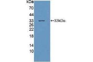 Detection of Recombinant gp130, Mouse using Polyclonal Antibody to Glycoprotein 130 (gp130) (CD130/gp130 Antikörper  (AA 238-500))