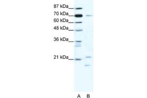 Western Blotting (WB) image for anti-Basic Transcription Factor 3 (BTF3) antibody (ABIN2461626)