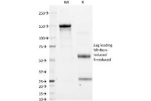 SDS-PAGE Analysis Purified CD11a Mouse Monoclonal Antibody (CRIS-3). (ITGAL Antikörper)
