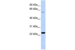Western Blotting (WB) image for anti-Zinc Finger Protein 460 (ZNF460) antibody (ABIN2459428) (ZNF460 Antikörper)