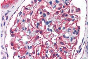 Human Kidney (formalin-fixed, paraffin-embedded) stained with ENPEP antibody ABIN351480 at 3. (ENPEP Antikörper  (AA 805-818))