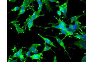 Immunofluorescent staining of undifferentiated (left) and differentiated (right) SH-SY5Y cells (ATCC CRL-2266, Human neuroblastoma). (TRKB Antikörper  (AA 156-322))