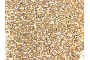 ABIN6255389 and ABIN6267301 at 1/100 staining Rat colon tissue by IHC-P.