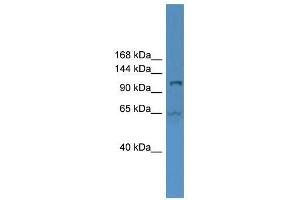 UBA6 antibody used at 0. (UBA6 Antikörper  (Middle Region))