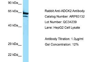 Western Blotting (WB) image for anti-AarF Domain Containing Kinase 2 (ADCK2) (C-Term) antibody (ABIN2789387) (ADCK2 Antikörper  (C-Term))