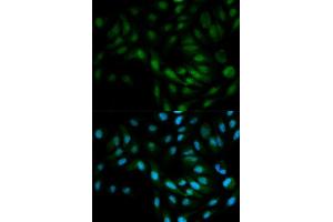 Immunofluorescence analysis of MCF7 cell using MAPK7 antibody. (MAPK7 Antikörper  (AA 1-310))