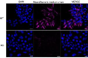 anti-Neurofilament Triplet M Protein (NEFM) antibody