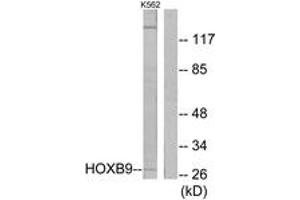 Western blot analysis of extracts from K562 cells, using HOXB9 Antibody.