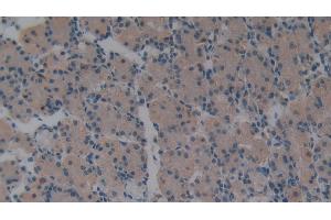Immunohistochemistry (IHC) image for anti-Villin 1 (VIL1) (AA 1-320) antibody (ABIN7435034)