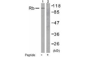 Image no. 2 for anti-Retinoblastoma 1 (RB1) (Ser807) antibody (ABIN197282) (Retinoblastoma 1 Antikörper  (Ser807))