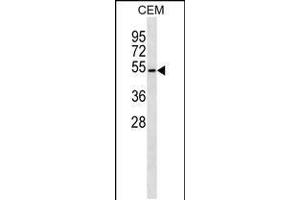 Western blot analysis in CEM cell line lysates (35ug/lane). (B4GALT4 Antikörper  (AA 91-117))