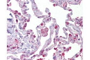 Anti-HPGDS / PGDS antibody IHC of human lung. (HPGDS Antikörper  (AA 35-84))