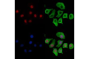ABIN6266074 and ABIN6269267 staining HepG2 cells by IF/ICC. (YAP1 Antikörper  (Internal Region))
