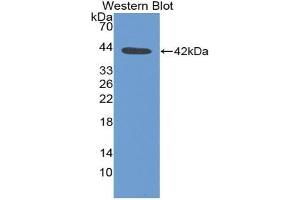 Western blot analysis of the recombinant protein. (Urocortin 1 Antikörper  (AA 34-120))