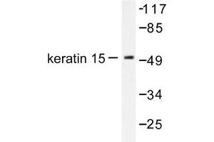 Image no. 1 for anti-Keratin 15 (KRT15) antibody (ABIN265494) (KRT15 Antikörper)