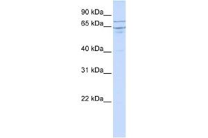 EDEM1 antibody used at 1 ug/ml to detect target protein. (EDEM1 Antikörper  (N-Term))