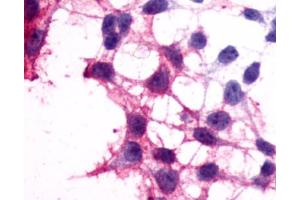 Anti-P2RY12 / P2Y12 antibody immunocytochemistry (ICC) staining of HEK293 human embryonic kidney cells transfected with P2RY12 / P2Y12. (P2RY12 Antikörper  (N-Term))
