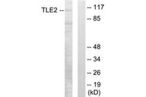 Western blot analysis of extracts from LOVO cells, using TLE2 Antibody. (TLE2 Antikörper  (AA 211-260))