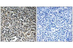 Immunohistochemistry analysis of paraffin-embedded human thymus gland tissue using CBLN4 antibody. (CBLN4 Antikörper  (C-Term))