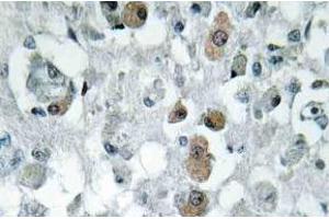 Immunohistochemistry (IHC) analyzes of GNPAT antibody in paraffin-embedded human brain tissue. (GNPAT Antikörper)