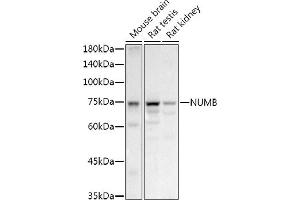 Western blot analysis of extracts of various cell lines, using NUMB antibody (ABIN6129424, ABIN6144943, ABIN6144944 and ABIN6224990) at 1:1000 dilution. (NUMB Antikörper  (AA 521-640))