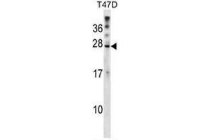 Western blot analysis in T47D cell line lysates (35µg/lane) using RNF4 Antibody (C-term) Cat. (RNF4 Antikörper  (C-Term))