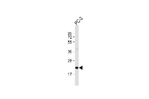 Anti-OBEC3C Antibody (C-Term) at 1:2000 dilution + PC-3 whole cell lysate Lysates/proteins at 20 μg per lane. (APOBEC3C Antikörper  (AA 143-177))