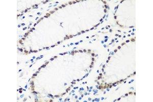 Immunohistochemistry of paraffin-embedded Human stomach using HTATSF1 Polyclonal Antibody at dilution of 1:100 (40x lens). (HTATSF1 Antikörper)