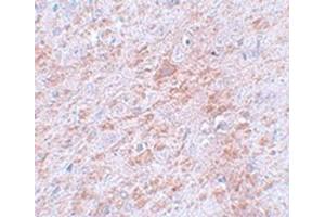 Immunohistochemical staining of rat brain tissue with DCLK2 polyclonal antibody  at 5 ug/mL dilution. (DCLK2 Antikörper  (C-Term))