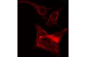 ABIN6266643 staining Hela cells by IF/ICC. (TGFA Antikörper)
