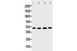Anti-DR5 antibody, Western blotting Lane 1: HELA Cell Lysate Lane 2: MM231 Cell Lysate Lane 3: SGC Cell Lysate Lane 4:  Cell Lysate (TNFRSF10B Antikörper  (C-Term))