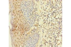 Immunohistochemistry of paraffin-embedded human tonsil tissue using ABIN7145011 at dilution of 1:100 (YME1L1 Antikörper  (AA 1-240))