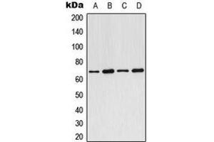 Western blot analysis of ARMCX2 expression in MCF7 (A), SP2/0 (B), PC12 (C), rat heart (D) whole cell lysates.