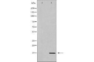 Western blot analysis of extracts of HeLa , using H3K36me3 Antibody The lane on the left is treated with the antigen-specific peptide. (Histone 3 Antikörper  (H3K36me3))
