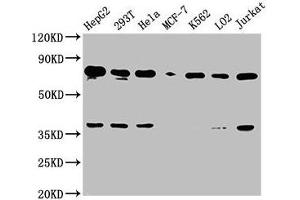 Western Blot Positive WB detected in: HepG2 whole cell lysate, 293T whole cell lysate, Hela whole cell lysate, MCF-7 whole cell lysate, K562 whole cell lysate, LO2 whole cell lysate, Jurkat whole cell lysate All lanes: UBC antibody at 1:2000 Secondary Goat polyclonal to rabbit IgG at 1/50000 dilution Predicted band size: 78 kDa Observed band size: 78 kDa (UBC Antikörper  (AA 19-36))