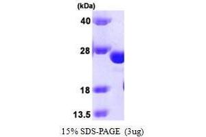 Figure annotation denotes ug of protein loaded and % gel used. (GSTK1 Protein (AA 1-226))