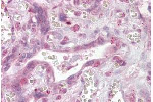 Anti-NFATC4 antibody IHC staining of human placenta. (NFATC4 Antikörper  (AA 953-965))