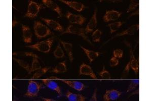 Immunofluorescence analysis of L929 cells using GTPBP8 Polyclonal Antibody at dilution of 1:100. (GTPBP8 Antikörper)