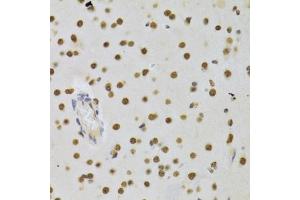 Immunohistochemistry of paraffin-embedded rat brain using DNMT3A Antibody (ABIN1872325) at dilution of 1:100 (40x lens). (DNMT3A Antikörper)