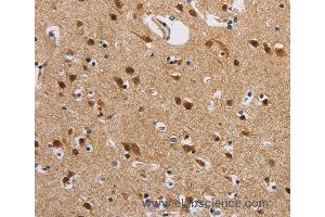 Immunohistochemistry of Human brain  using IL19 Polyclonal Antibody at dilution of 1:40
