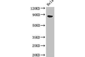 Western Blot Positive WB detected in: Hela whole cell lysate All lanes: APEH antibody at 3 μg/mL Secondary Goat polyclonal to rabbit IgG at 1/50000 dilution Predicted band size: 82 kDa Observed band size: 82 kDa (APEH Antikörper  (AA 201-500))