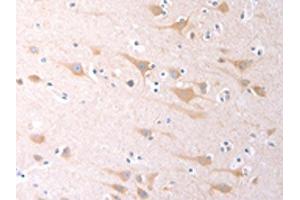 The image on the left is immunohistochemistry of paraffin-embedded Human brain tissue using ABIN7130977(SCGB1A1 Antibody) at dilution 1/60, on the right is treated with fusion protein. (SCGB1A1 Antikörper)