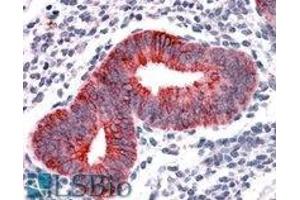 AP22445PU-N VPS29 antibody staining of paraffin embedded Human Uterus at 3. (VPS29 Antikörper  (Internal Region))