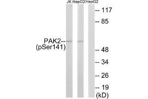 Western blot analysis of extracts from HepG2 cells treated with Adriamycin (0. (PAK2 Antikörper  (pSer141))