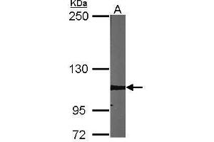 Western Blotting (WB) image for anti-Adenosine Deaminase, RNA-Specific (ADAR) antibody (ABIN2855100)