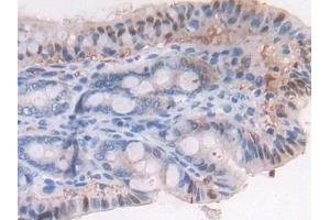 Immunohistochemistry (IHC) image for anti-Latent Transforming Growth Factor beta Binding Protein 1 (LTBP1) (AA 1415-1712) antibody (ABIN7440761)