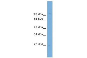 TPPP3 antibody used at 1 ug/ml to detect target protein. (TPPP3 Antikörper  (N-Term))